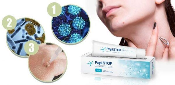 Hình ảnh kem bôi Papistop – Giải pháp tối ưu cho mụn cóc và mụn thịt