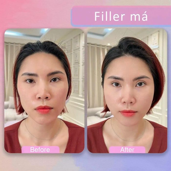 Hình ảnh thực tế dịch vụ tại Trân Châu Beauty & Clinic