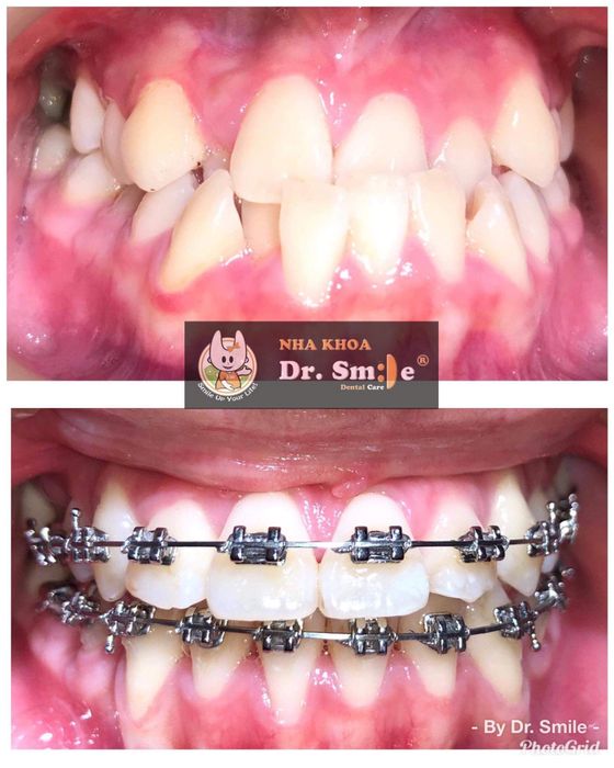 Khám phá không gian sang trọng và hệ thống trang thiết bị hiện đại tại Nha Khoa Dr. Smile Đà Lạt
