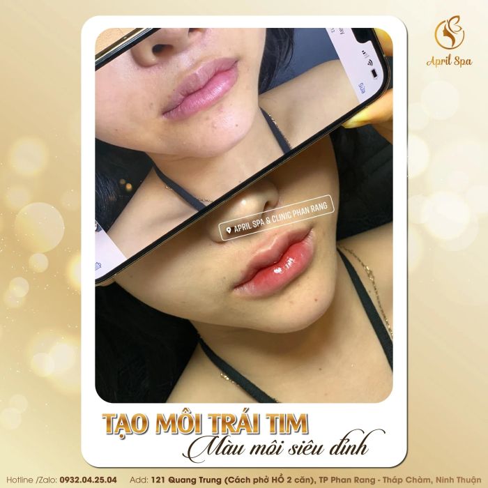 Không gian sang trọng tại April Spa & Clinic