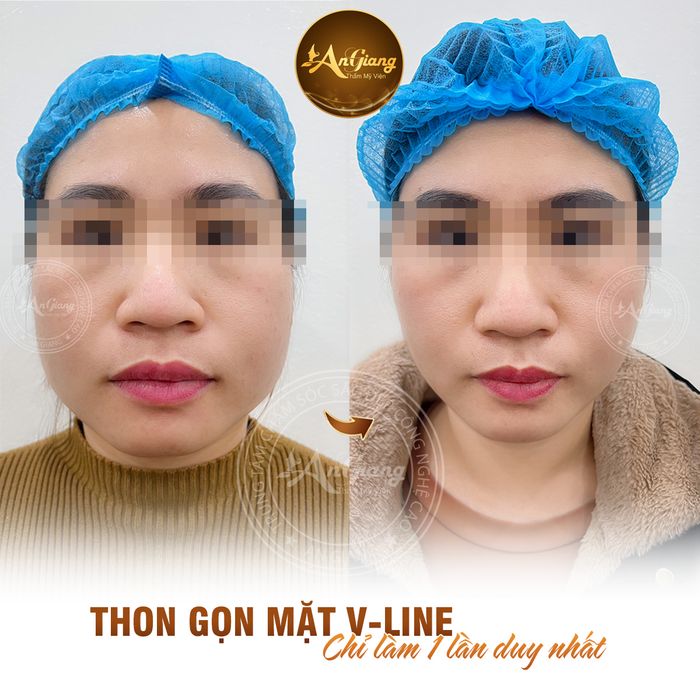 Thẩm Mỹ Viện AN GIANG - Hình ảnh 1