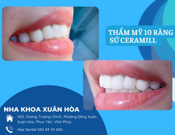 Không gian hiện đại và chuyên nghiệp tại NHA KHOA XUÂN HOÀ