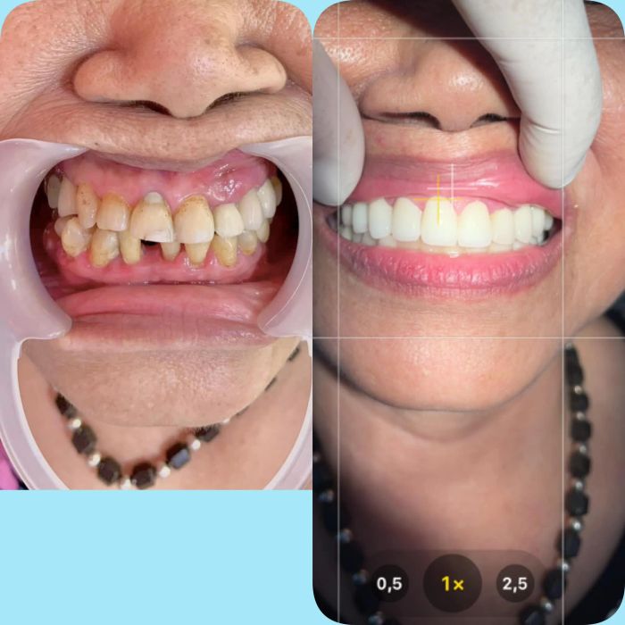 Hệ thống máy móc hiện đại tại NHA KHOA XUÂN HOÀ