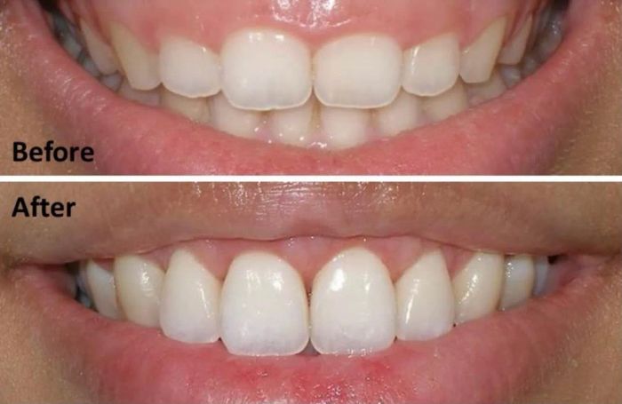 Không gian hiện đại và chuyên nghiệp tại NHA KHOA HÀ NỘI