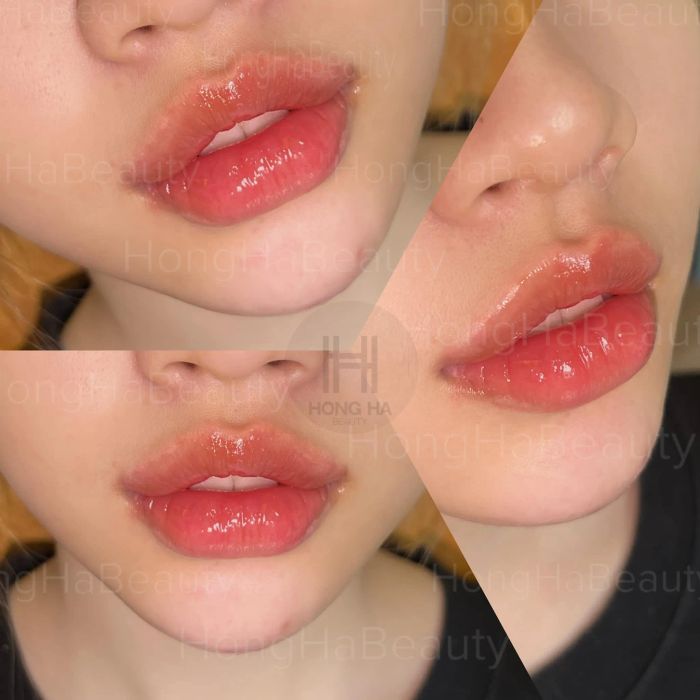 Hình ảnh thực tế tại Hồng Hà Beauty