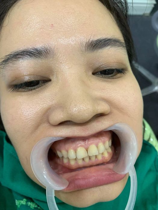 Hệ thống máy móc hiện đại tại NHA KHOA HÀ NỘI