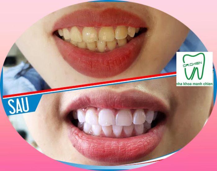 Hình ảnh phòng khám Nha Khoa Mạnh Chiến (ảnh 1)