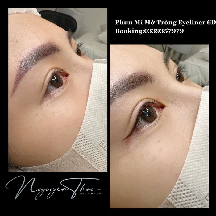 Bộ sưu tập thành phẩm ấn tượng từ Nguyễn Thảo Beauty Spa & Clinic