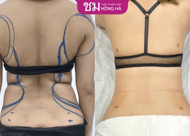 Thẩm Mỹ Bệnh Viện Hồng Hà - Hình ảnh 2