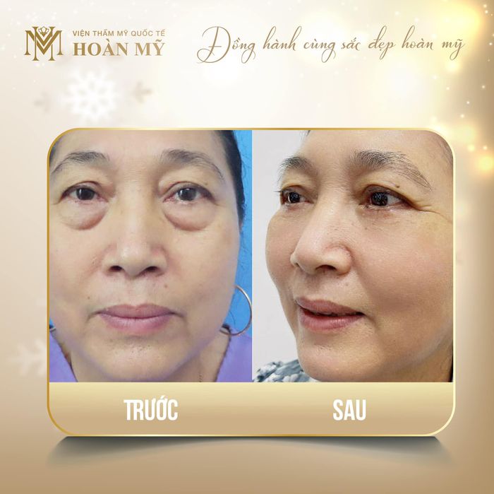 Không gian làm đẹp sang trọng tại Viện thẩm mỹ Quốc tế Hoàn Mỹ