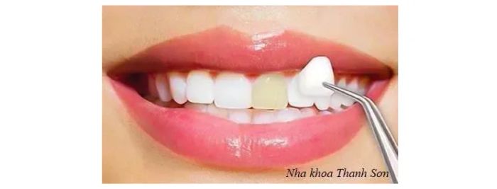 Hình ảnh thực tế phòng khám Nha khoa Thanh Sơn - không gian hiện đại đạt chuẩn y khoa