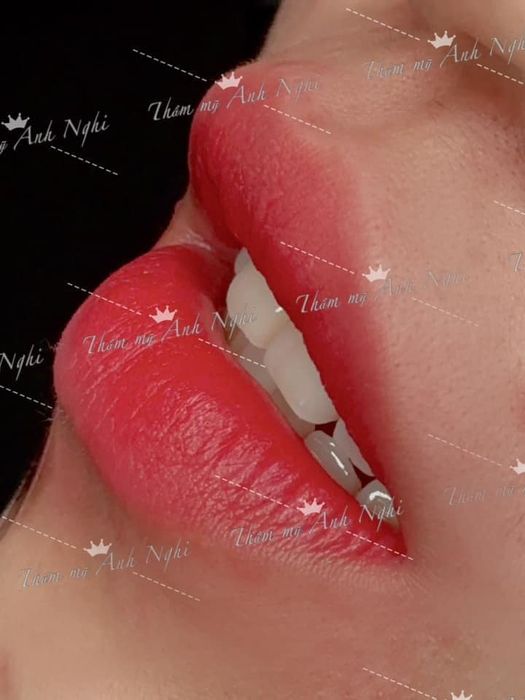 Bộ sưu tập thành phẩm ấn tượng từ Anh Nghi Thẩm Mỹ