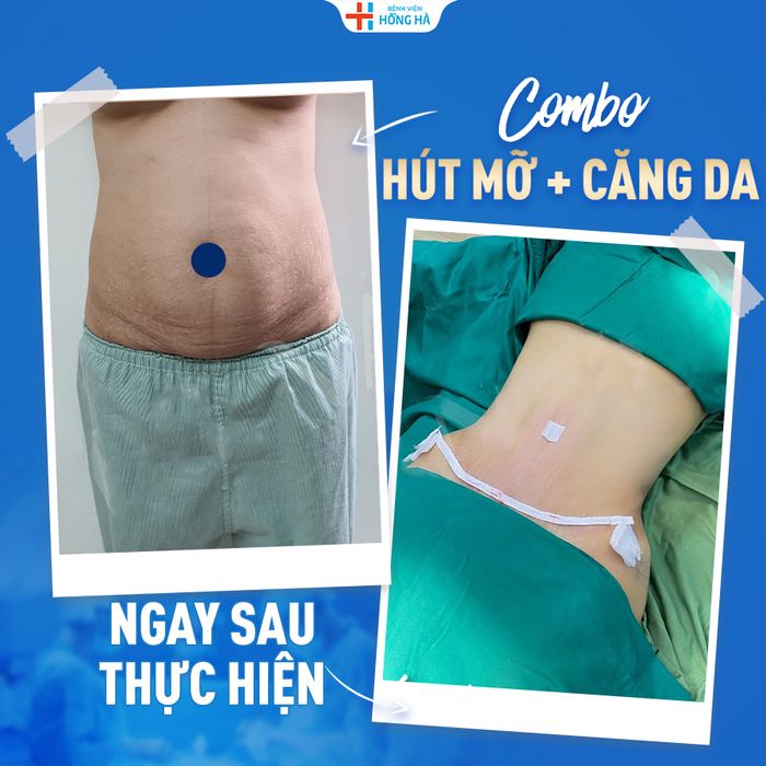 Thẩm Mỹ Bệnh Viện Hồng Hà - Hình ảnh 1