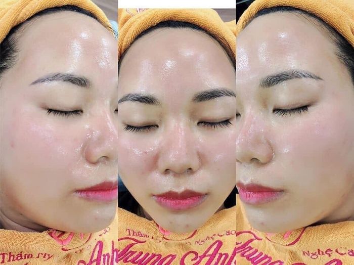 Thẩm Mỹ Trung Anh - Hình ảnh 2