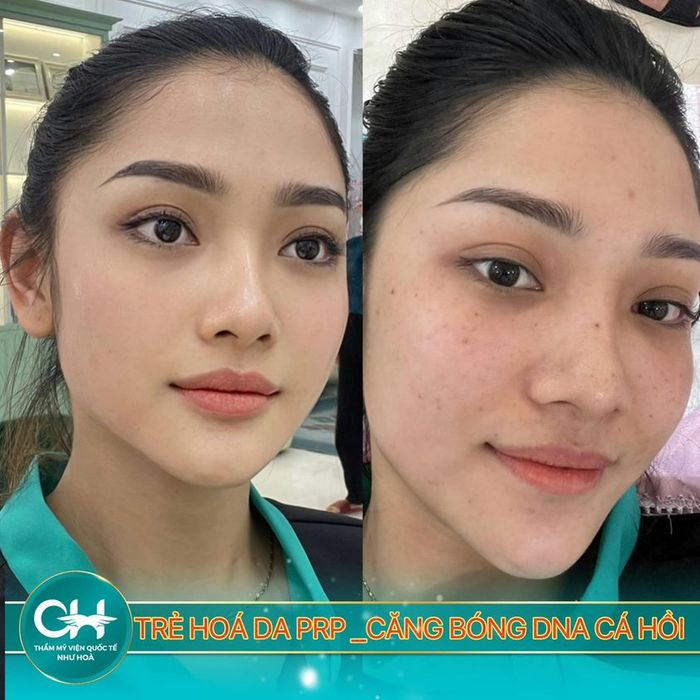 Thẩm Mỹ Viện Quốc Tế Như Hoa - Hình ảnh 1
