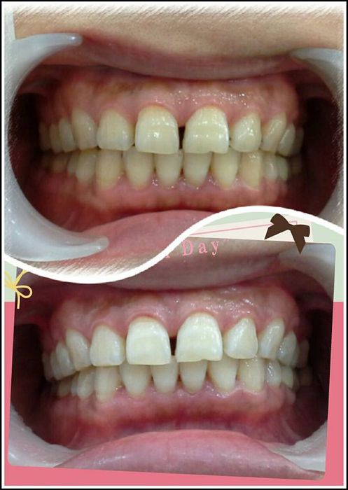 Hình ảnh thực tế tại Nha khoa Cao Chiến (ảnh 1)