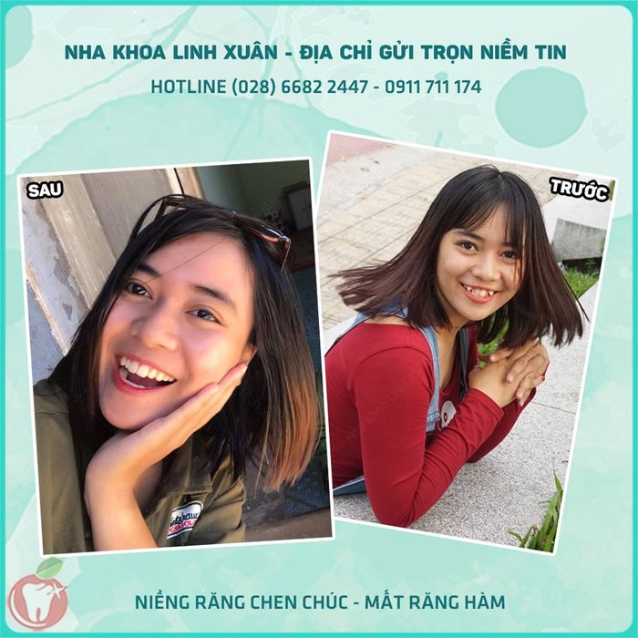 Nha Khoa LINH XUÂN ảnh 1