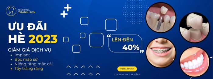 Bộ sưu tập hình ảnh case study dán sứ Veneer thành công tại Nha khoa Thanh Sơn