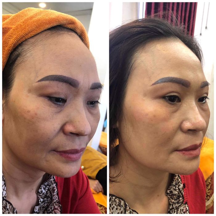 Thẩm Mỹ Trung Anh - Hình ảnh 1