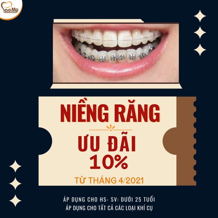 Hình ảnh thực tế quy trình niềng răng Invisalign tại Nha Khoa Sao Mỹ