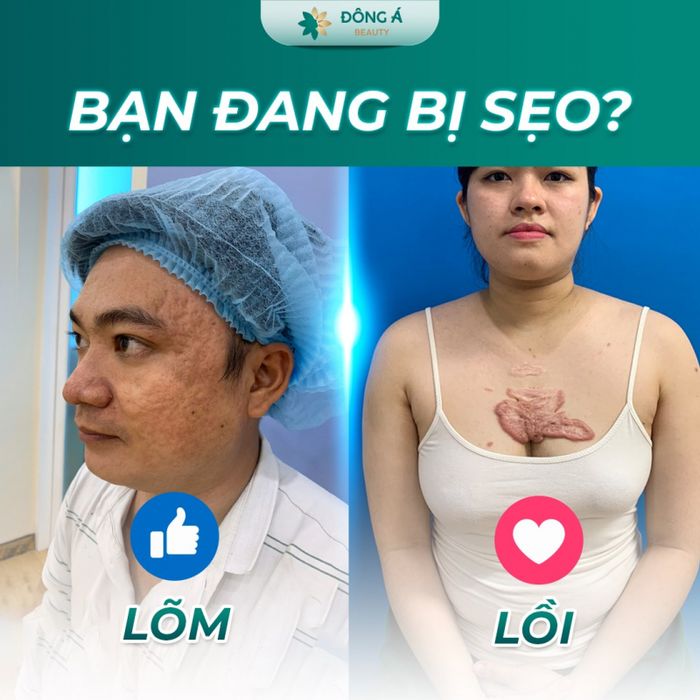 Không gian điều trị sẹo lồi chuẩn Nhật tại Đông Á