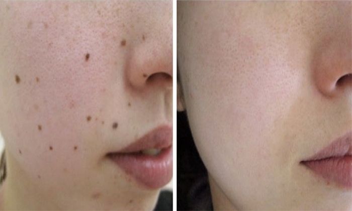 Khu vực thăm khám và điều trị tại Bệnh viện Da Liễu TP.HCM