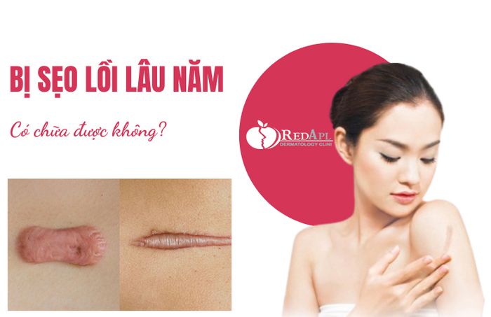 Hình ảnh trị liệu chuyên nghiệp tại Phòng Khám Da Liễu Táo Đỏ