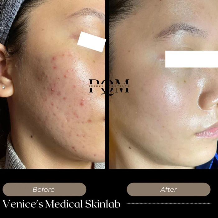 Venice Spa & Beauty Center - Hình ảnh ấn tượng về không gian sang trọng và dịch vụ chăm sóc da đẳng cấp