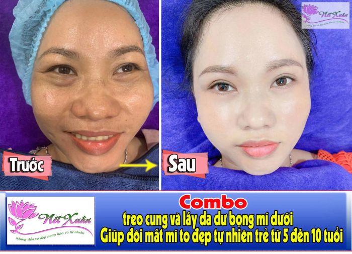 Bộ sưu tập hình ảnh đẹp tại Thẩm mỹ Viện Nét Xuân - minh chứng cho sự chuyên nghiệp và tinh tế