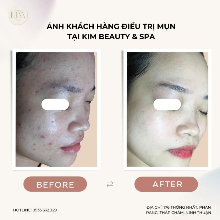 Hình ảnh không gian sang trọng tại Kim Beauty Spa