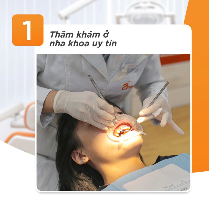 Hình ảnh minh họa quá trình niềng răng chuyên nghiệp tại Nha khoa Up Dental