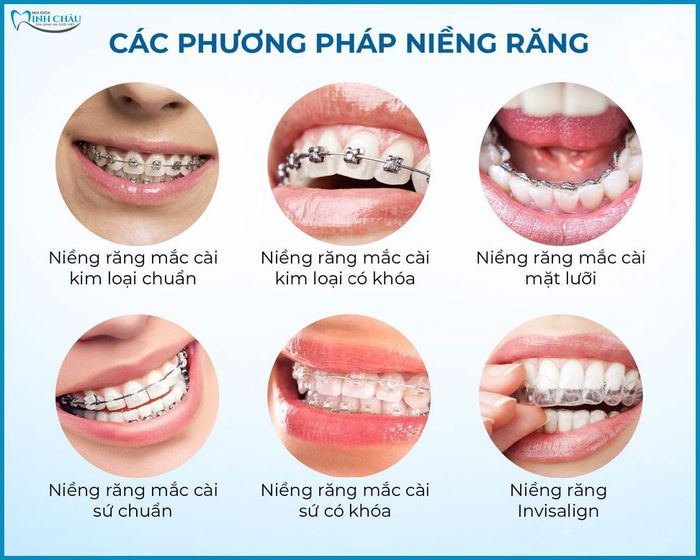 Hình ảnh đội ngũ bác sĩ chuyên môn tại Nha Khoa Minh Châu