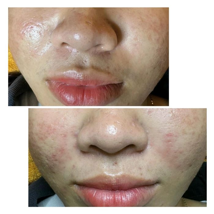 Khu vực điều trị chuyên nghiệp với trang thiết bị hiện đại