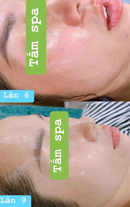 Khu vực điều trị chuyên nghiệp tại Tấm Spa