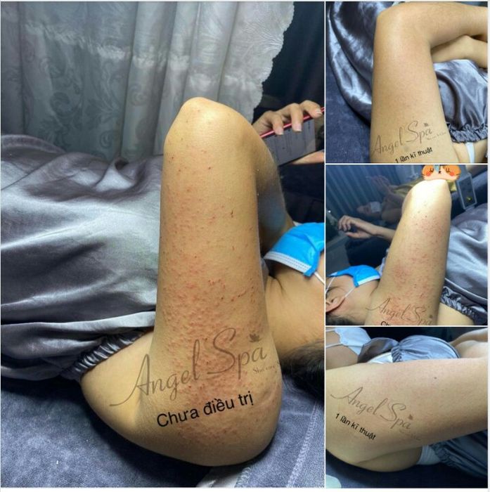 ANGEL SPA ảnh 2