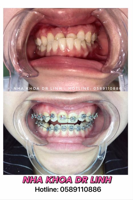 Thư viện hình ảnh Nha khoa Dr.Linh - Trang thiết bị hiện đại bậc nhất