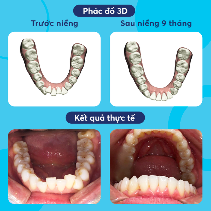 Thư viện hình ảnh Nha Khoa Việt Hàn - Cơ sở vật chất hiện đại bậc nhất