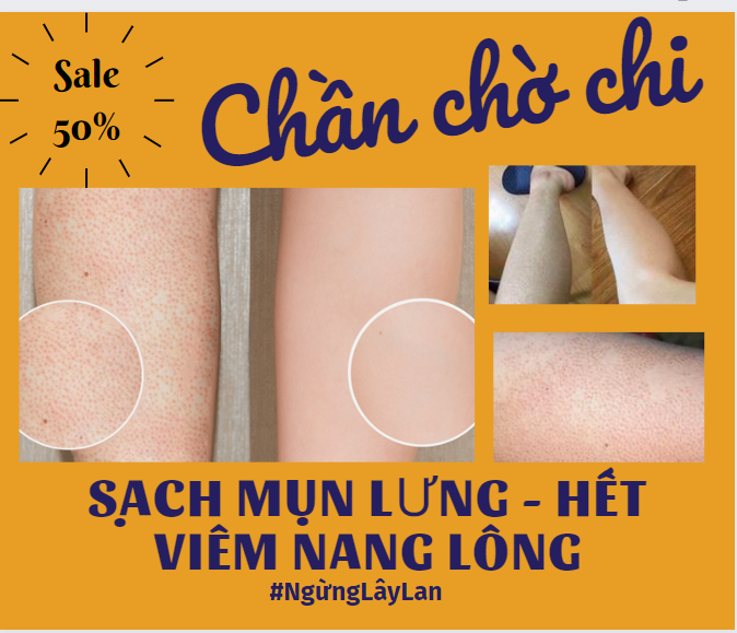 Dolly beauty spa ảnh 1
