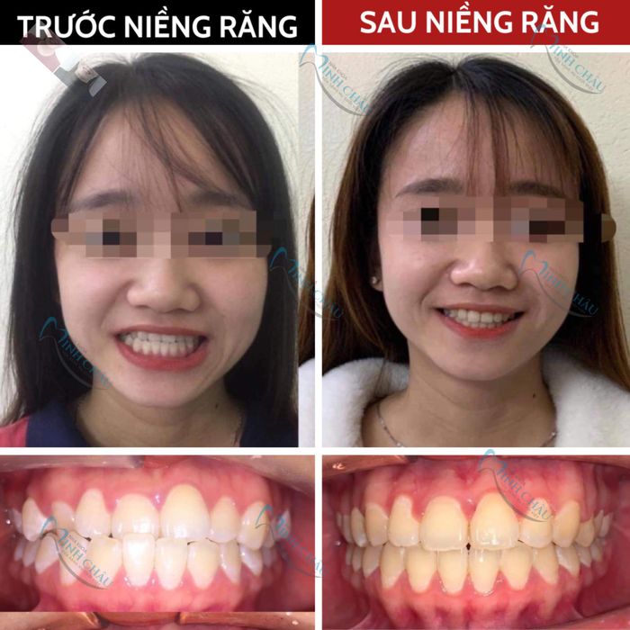 Hình ảnh cơ sở vật chất hiện đại tại Nha Khoa Minh Châu