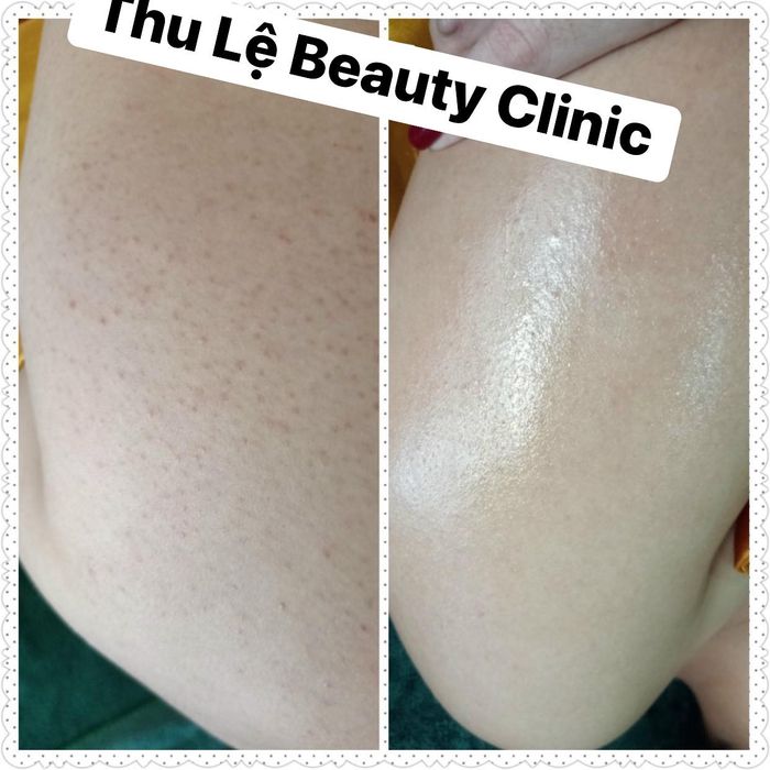 Thu Lệ Beauty Clinic Spa ảnh 2