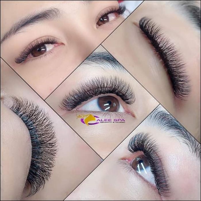 Calee Spa Beauty & Clinic ảnh 2