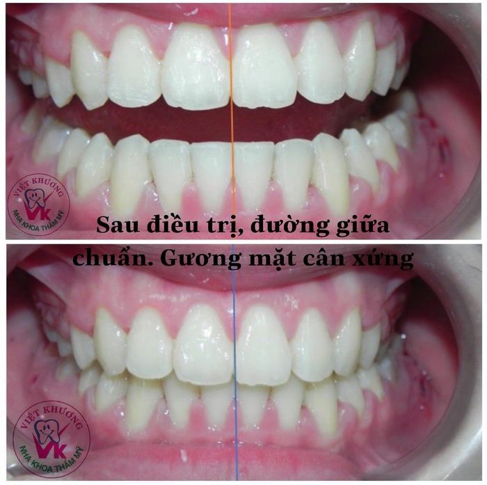 Thư viện hình ảnh Nha Khoa Việt Khương - Trang thiết bị hiện đại bậc nhất