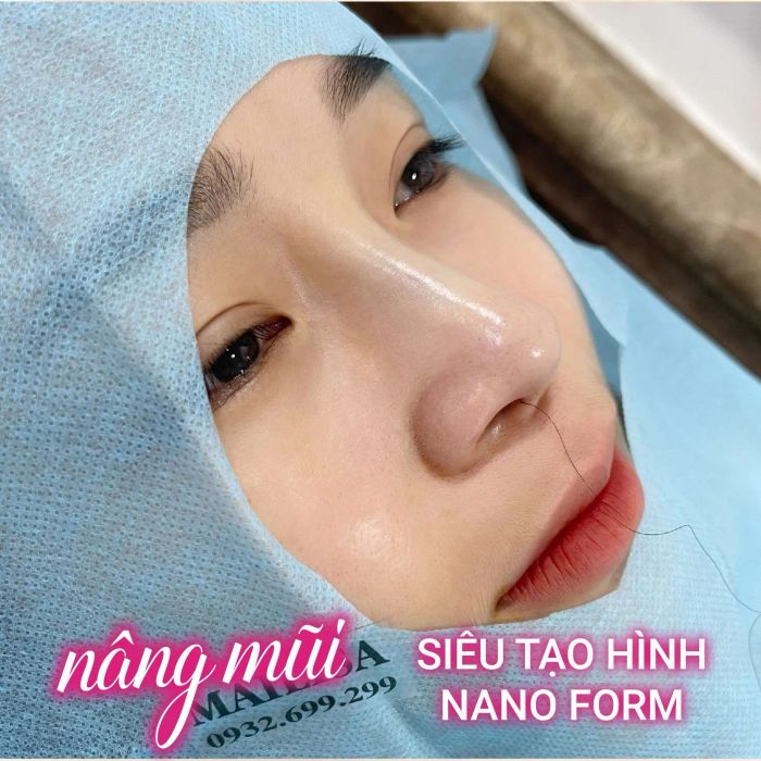 Hệ thống máy móc hiện đại bậc nhất tại Viện Thẩm Mỹ Mailisa - Ảnh 2