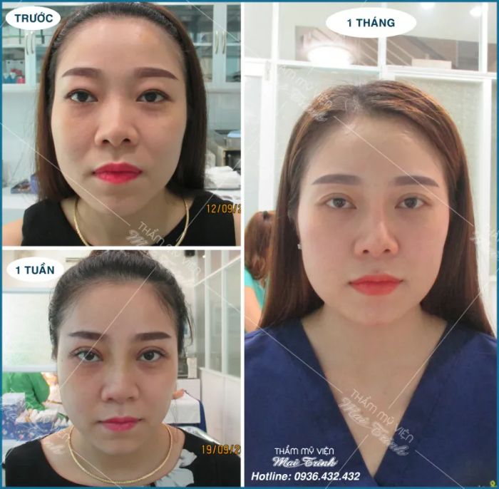 Hệ thống máy móc hiện đại tại Viện Thẩm Mỹ MAI TRINH - Ảnh 2