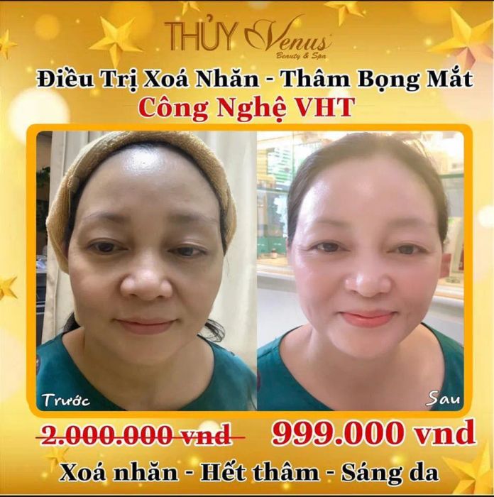 Quy trình phẫu thuật thẩm mỹ chuẩn y khoa tại Viện Thẩm Mỹ Thuỷ Venus - Ảnh 2
