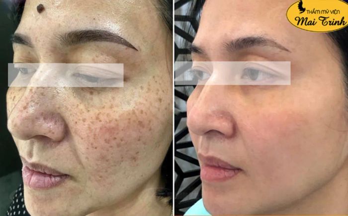 Góc làm đẹp cao cấp tại Viện Thẩm Mỹ MAI TRINH - Ảnh 3