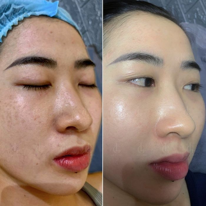 Thẩm Mỹ Viện Quốc Tế Little Garden Spa Hình Ảnh 2