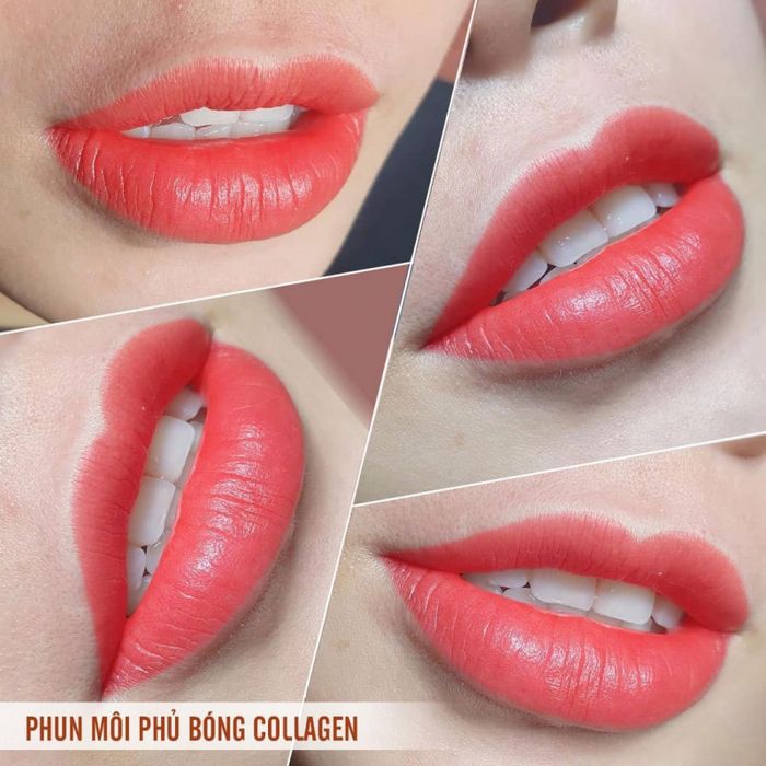 Viện Thẩm Mỹ Kia Spa Hình Ảnh 1