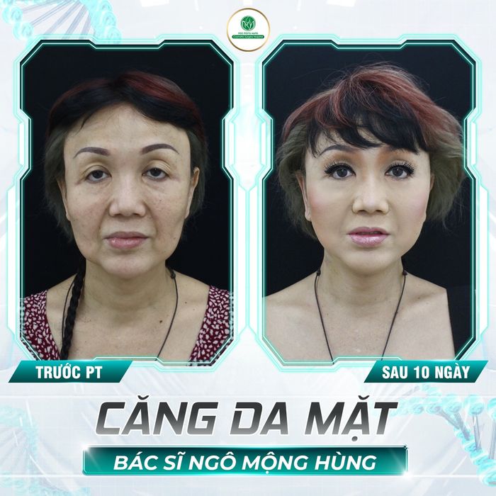 Không gian sang trọng Bệnh Viện Thẩm Mỹ Ngô Mộng Hùng - Nơi đẹp từng centimet