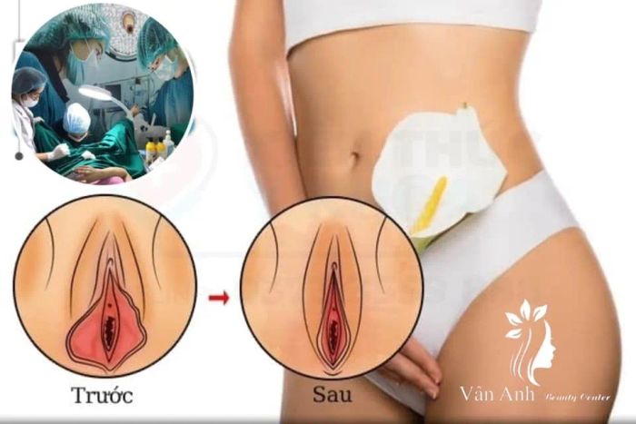 Hình ảnh quy trình thẩm mỹ chuẩn y khoa tại Vân Anh Beauty Center